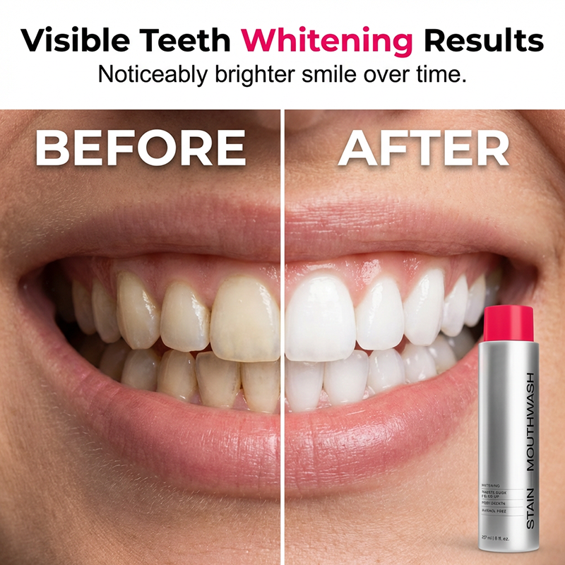 🥳2026 HOT SALE🥳😁 50% OFF! ✨Stain‑Removing Whitening Mouthwash – Lifts coffee & tea stains, alcohol‑free. Instant gunk binding, long‑lasting minty fresh. Gentle enough for daily use. 🦷💙